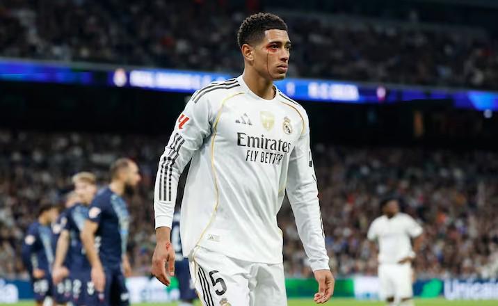 阿斯:皇马对贝林被肘后裁判未看回放感到愤怒,认为标准不一