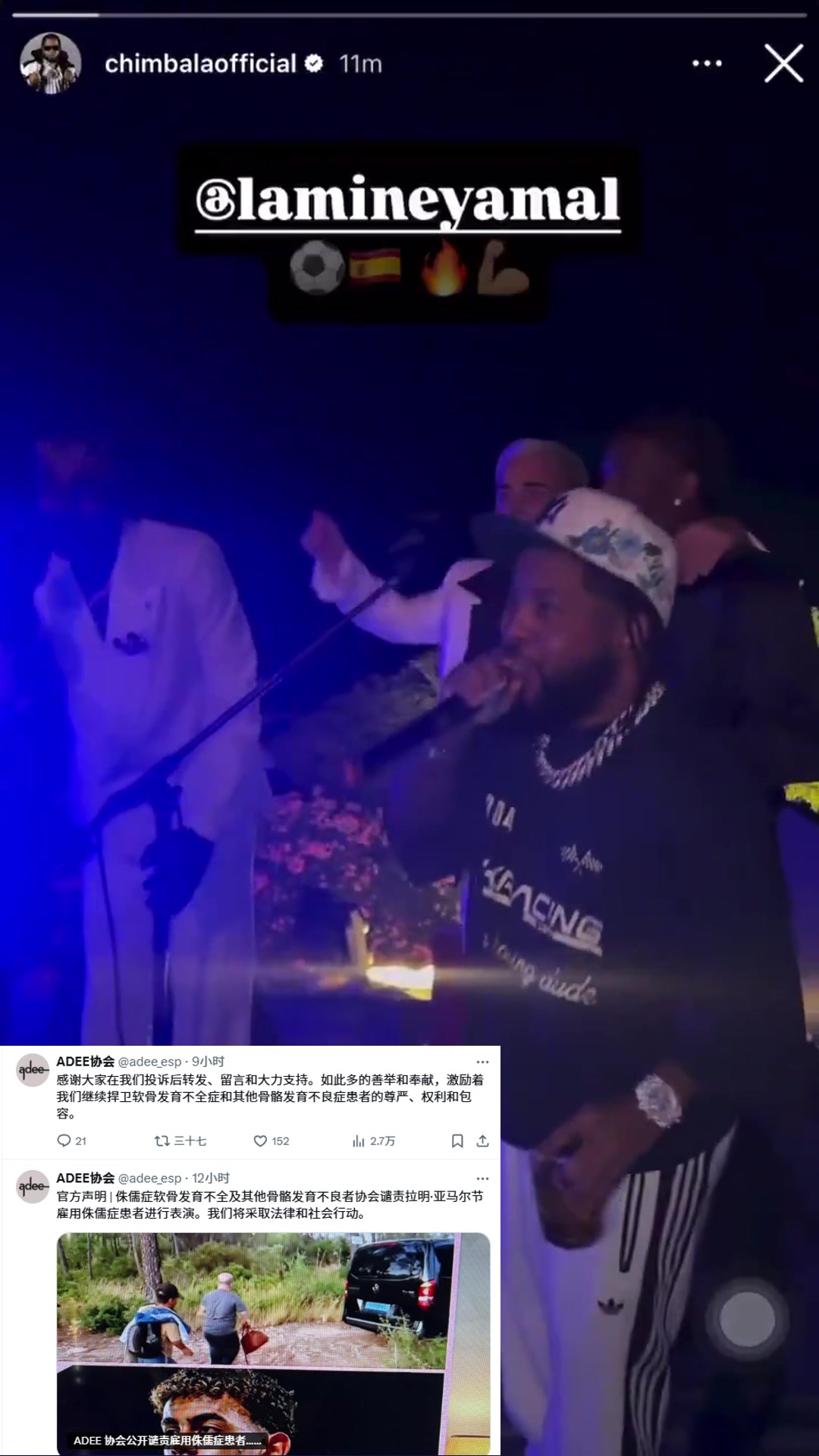 西班牙ADEE将起诉亚马尔雇佣侏儒症歌手谴责物化侏儒症